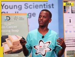 Meet 14-year-old student who invented soap to treat skin cancer, costs just…